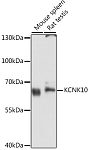 Western blot - KCNK10 Rabbit pAb (A11681)