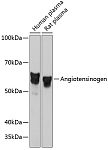 Western blot - Angiotensinogen Rabbit mAb (A11689)