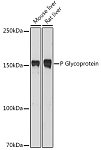 Western blot - P Glycoprotein Rabbit pAb (A11747)