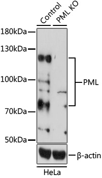 [KO Validated] PML Rabbit polyclonal antibody