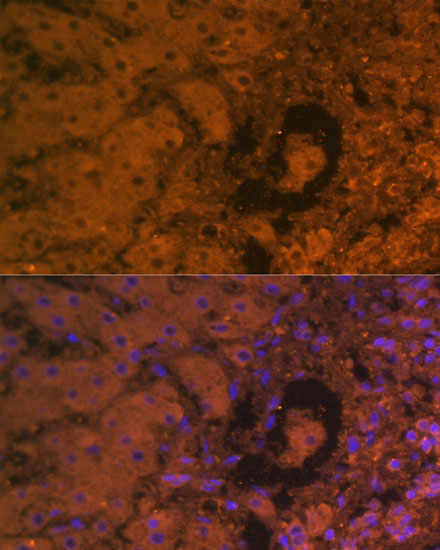 Alpha-Fetoprotein (AFP) Mouse monoclonal antibody