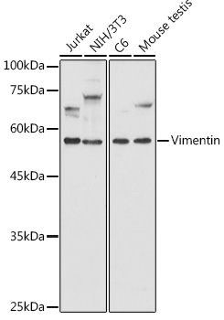[KD Validated] Vimentin Rabbit polyclonal antibody