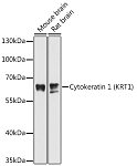 Western blot - Cytokeratin 1 (KRT1) Rabbit pAb (A11958)