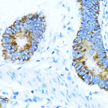 NOX1 Rabbit polyclonal antibody