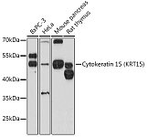Western blot - Cytokeratin 15 (KRT15) Rabbit pAb (A12155)