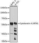 Western blot - Cytokeratin 4 (KRT4) Rabbit pAb (A12156)
