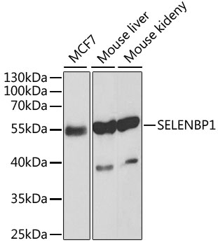 [KO Validated] SELENBP1 Rabbit polyclonal antibody