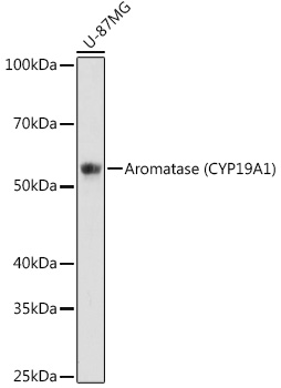 Aromatase (CYP19A1) Rabbit mAb