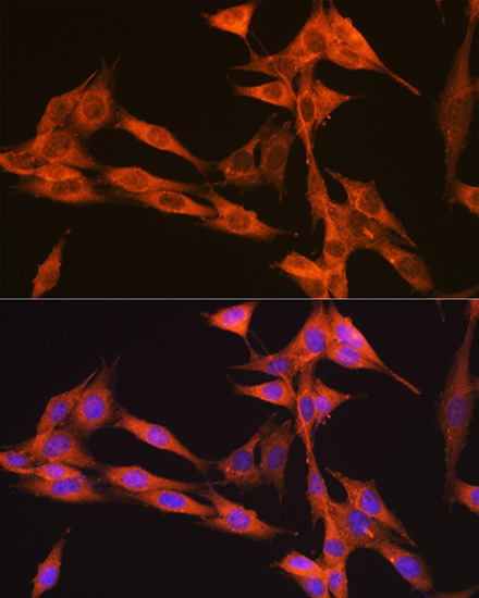 ABclonal:Immunofluorescence - PIK3C3/VPS34 Rabbit mAb (A12295)}