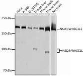 Western blot - NSD3/WHSC1L1 Rabbit mAb (A12342)
