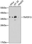 Western blot - TNFSF13 Rabbit pAb (A1237)