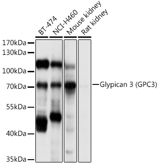 Glypican 3 (GPC3) Rabbit pAb