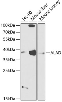 ALAD Rabbit pAb