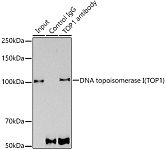 Western blot - DNA topoisomerase I (TOP1) Rabbit mAb (A12409)