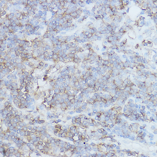 [KO Validated] CD44 Rabbit polyclonal antibody