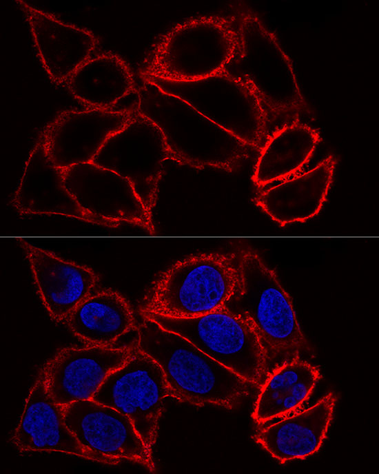 [KO Validated] CD44 Rabbit polyclonal antibody