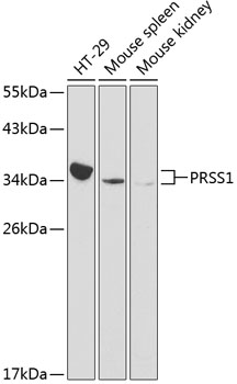 PRSS1 Rabbit polyclonal antibody