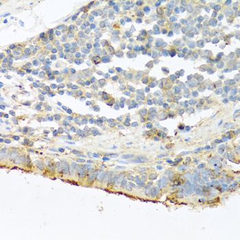 PRSS1 Rabbit polyclonal antibody