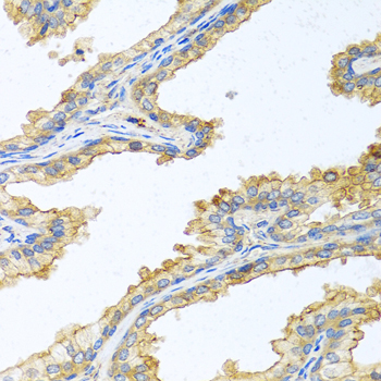PRSS1 Rabbit polyclonal antibody