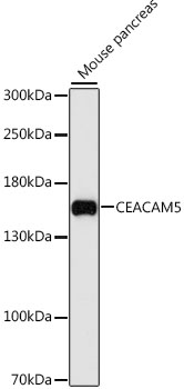 CEACAM5 Rabbit polyclonal antibody