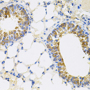CEACAM5 Rabbit polyclonal antibody