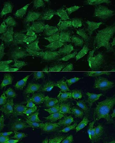 [KO Validated] SHP2 Rabbit polyclonal antibody