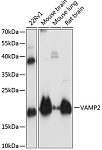 Western blot - VAMP2 Rabbit pAb (A1249)