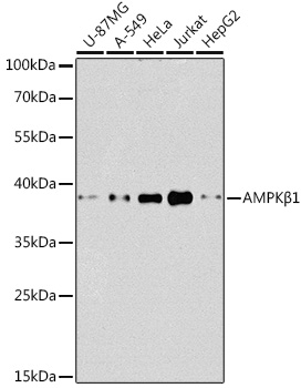 [KO Validated] AMPKB Beta1 Rabbit polyclonal antibody