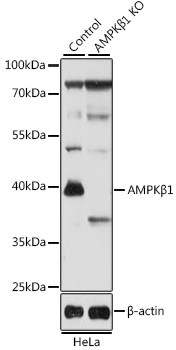 [KO Validated] AMPKB Beta1 Rabbit polyclonal antibody