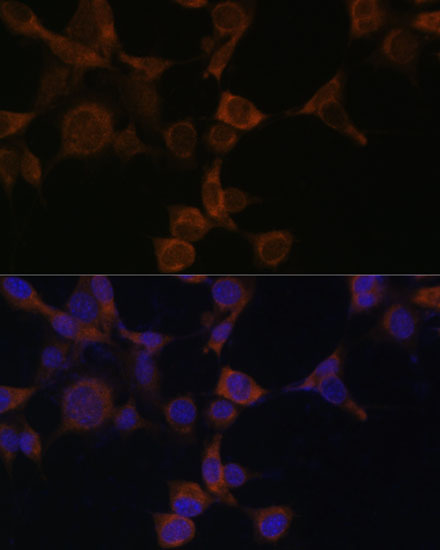 [KO Validated] AMPKB Beta1 Rabbit polyclonal antibody