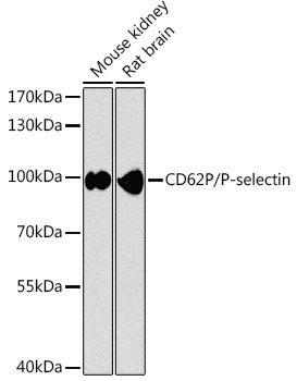 CD62P/P-selectin Rabbit pAb