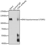 Western blot - DNA topoisomerase I (TOP1) Rabbit pAb (A12524)