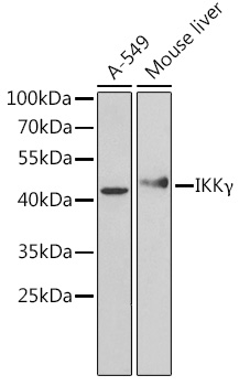 [KO Validated] IKKG Gamma Rabbit polyclonal antibody