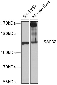 SAFB2 Rabbit polyclonal antibody