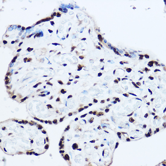 SAFB2 Rabbit polyclonal antibody