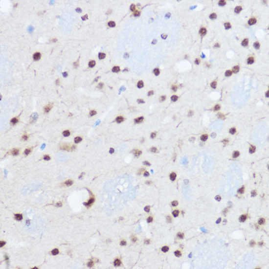 SAFB2 Rabbit polyclonal antibody