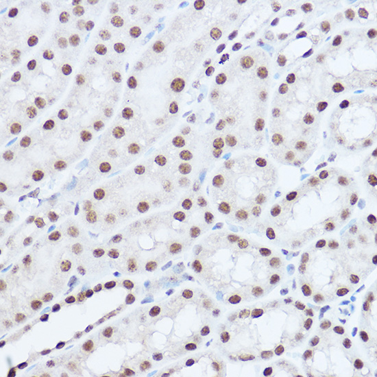 SAFB2 Rabbit polyclonal antibody