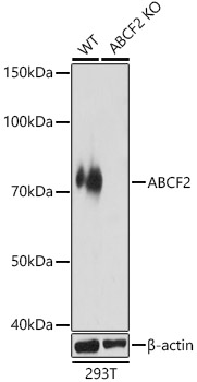 [KO Validated] ABCF2 Rabbit polyclonal antibody
