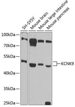 KCNK9 Rabbit pAb