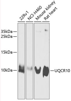 SLC28A3 antibody