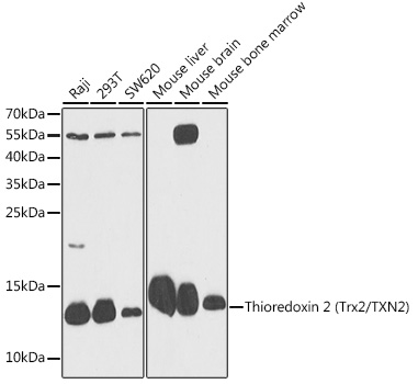 SLC26A6 antibody