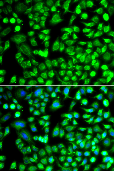 FCRL4 antibody