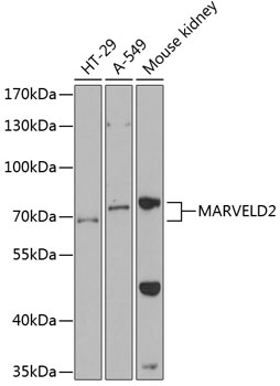 RAD23B antibody
