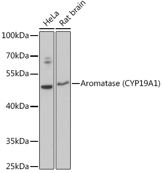 Aromatase (CYP19A1) Rabbit pAb