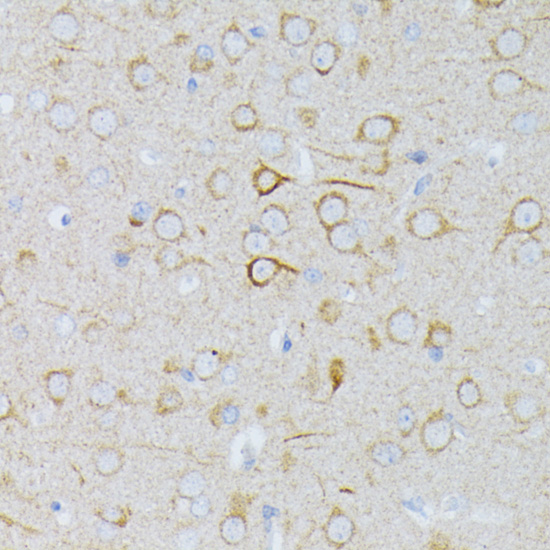 [KO Validated] MEK1 Rabbit polyclonal antibody