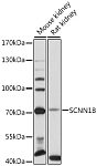 Western blot - SCNN1B Rabbit pAb (A12699)