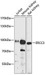 Western blot - ERCC3 Rabbit pAb (A12702)