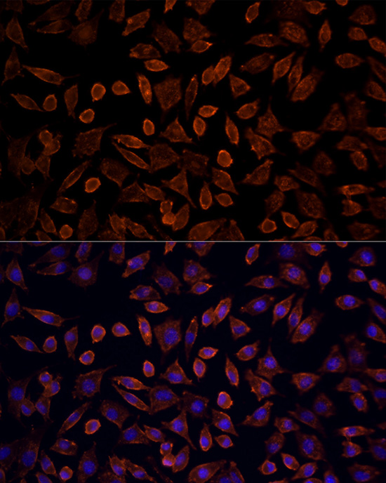 [KO Validated] KRAS Rabbit polyclonal antibody
