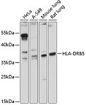 Western blot - HLA-DRB5 Rabbit pAb (A12726)