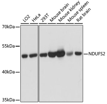[KO Validated] NDUFS2 Rabbit polyclonal antibody
